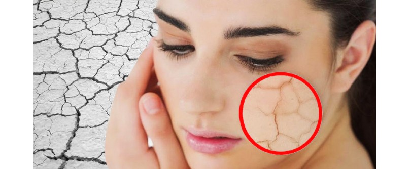 Sausas oras – daugybės negalavimų priežastis